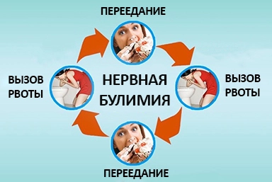 Лечение булимии в Кудрово